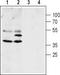 Aquaporin-4 antibody, TA329023, Origene, Western Blot image 