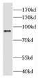 Diacylglycerol kinase beta antibody, FNab02357, FineTest, Western Blot image 