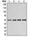 Cyclin B1 antibody, GTX55085, GeneTex, Western Blot image 