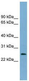 Protein lin-37 homolog antibody, TA344818, Origene, Western Blot image 