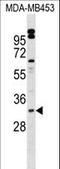 Homeobox protein VENTX antibody, LS-C157349, Lifespan Biosciences, Western Blot image 