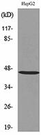 Homeobox protein Hox-D3 antibody, A07544, Boster Biological Technology, Western Blot image 