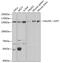 Ubiquitin Specific Peptidase 7 antibody, GTX32957, GeneTex, Western Blot image 