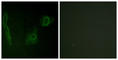 ALK Receptor Tyrosine Kinase antibody, abx012794, Abbexa, Western Blot image 