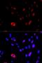 HUS1 Checkpoint Clamp Component antibody, orb167321, Biorbyt, Immunofluorescence image 