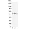 Interferon Regulatory Factor 8 antibody, R31333, NSJ Bioreagents, Western Blot image 
