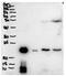 BPI Fold Containing Family A Member 1 antibody, AP32703PU-N, Origene, Western Blot image 