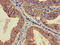 Ribosomal Protein S21 antibody, LS-C669620, Lifespan Biosciences, Immunohistochemistry paraffin image 
