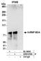 Heterogeneous nuclear ribonucleoprotein M antibody, A303-910A, Bethyl Labs, Immunoprecipitation image 
