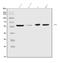 Carboxypeptidase N Subunit 1 antibody, A05704-2, Boster Biological Technology, Western Blot image 
