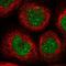 Armadillo Repeat Containing 4 antibody, NBP1-84175, Novus Biologicals, Immunocytochemistry image 