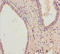 Retinol Dehydrogenase 11 antibody, A55323-100, Epigentek, Immunohistochemistry paraffin image 
