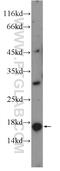 Sperm Acrosome Associated 9 antibody, 26034-1-AP, Proteintech Group, Western Blot image 