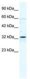 Gap Junction Protein Beta 1 antibody, TA341661, Origene, Western Blot image 