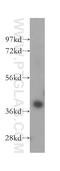 Haptoglobin antibody, 16665-1-AP, Proteintech Group, Western Blot image 
