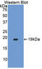Atrial natriuretic peptide-converting enzyme antibody, LS-C293532, Lifespan Biosciences, Western Blot image 