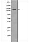 ADAM Metallopeptidase With Thrombospondin Type 1 Motif 14 antibody, orb337968, Biorbyt, Western Blot image 