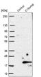 Chromosome 19 Open Reading Frame 48 antibody, PA5-59814, Invitrogen Antibodies, Western Blot image 