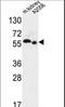 hMATE-2 antibody, LS-C162843, Lifespan Biosciences, Western Blot image 