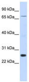 Zinc Finger Protein 267 antibody, TA339069, Origene, Western Blot image 