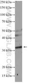 NUS1 Dehydrodolichyl Diphosphate Synthase Subunit antibody, 15986-1-AP, Proteintech Group, Western Blot image 
