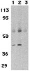 C-C Motif Chemokine Receptor 3 antibody, GTX31255, GeneTex, Western Blot image 