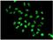 p84N5 antibody, ab131268, Abcam, Immunofluorescence image 