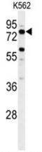 Acyl-CoA Synthetase Bubblegum Family Member 2 antibody, AP50042PU-N, Origene, Western Blot image 