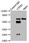 CTP Synthase 2 antibody, LS-C397231, Lifespan Biosciences, Immunoprecipitation image 