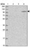 hMCS antibody, NBP2-14242, Novus Biologicals, Western Blot image 