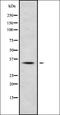WAP, Follistatin/Kazal, Immunoglobulin, Kunitz And Netrin Domain Containing 1 antibody, orb338334, Biorbyt, Western Blot image 