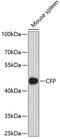 Complement Factor Properdin antibody, GTX53957, GeneTex, Western Blot image 