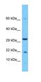 Erythrocyte Membrane Protein Band 4.1 Like 4A antibody, orb331388, Biorbyt, Western Blot image 