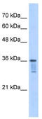 Leucine Zipper Transcription Factor Like 1 antibody, TA346633, Origene, Western Blot image 
