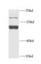 Glutamic--Pyruvic Transaminase antibody, FNab03619, FineTest, Western Blot image 