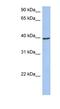 Acyl-CoA Dehydrogenase Medium Chain antibody, NBP1-54729, Novus Biologicals, Western Blot image 