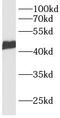 Calcium Voltage-Gated Channel Auxiliary Subunit Gamma 7 antibody, FNab01181, FineTest, Western Blot image 