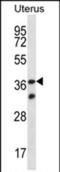 Olfactory Receptor Family 4 Subfamily X Member 2 (Gene/Pseudogene) antibody, PA5-71800, Invitrogen Antibodies, Western Blot image 