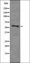 Olfactory Receptor Family 2 Subfamily T Member 6 antibody, orb335663, Biorbyt, Western Blot image 