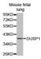 Dual specificity protein phosphatase 1 antibody, TA327446, Origene, Western Blot image 