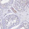 Glutaryl-CoA Dehydrogenase antibody, HPA043252, Atlas Antibodies, Immunohistochemistry frozen image 