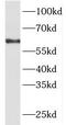 Protein Kinase C And Casein Kinase Substrate In Neurons 2 antibody, FNab06101, FineTest, Western Blot image 