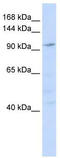 NODAL Modulator 1 antibody, TA334505, Origene, Western Blot image 
