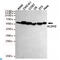 Aldehyde dehydrogenase, mitochondrial antibody, LS-C812877, Lifespan Biosciences, Western Blot image 