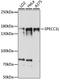 Sperm Antigen With Calponin Homology And Coiled-Coil Domains 1 Like antibody, A15798, ABclonal Technology, Western Blot image 