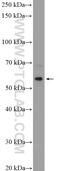 TELO2 Interacting Protein 2 antibody, 20779-1-AP, Proteintech Group, Western Blot image 