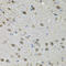Cyclophilin D antibody, 22-579, ProSci, Immunohistochemistry frozen image 