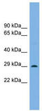 Homeobox protein notochord antibody, TA341740, Origene, Western Blot image 