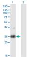 Neurexophilin 3 antibody, MA5-21314, Invitrogen Antibodies, Western Blot image 