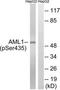 RUNX Family Transcription Factor 1 antibody, TA313289, Origene, Western Blot image 